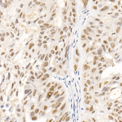 Invitrogen SOCS1 Recombinant Rabbit Monoclonal Antibody (6C6W1):Antibodies:Primary