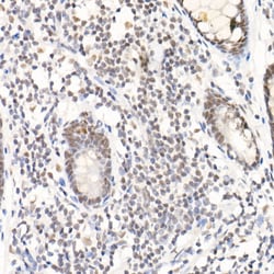 Invitrogen SOCS1 Recombinant Rabbit Monoclonal Antibody (6C6W1) 20 &mu;L;