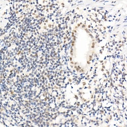 Invitrogen SOCS1 Recombinant Rabbit Monoclonal Antibody (6C6W1):Antibodies:Primary