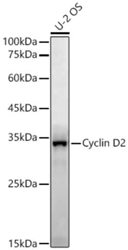 Invitrogen Cyclin D2 Recombinant Rabbit Monoclonal Antibody (5B4M7) 100