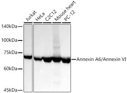 Invitrogen Annexin A6 Recombinant Rabbit Monoclonal Antibody (7X4H2):Antibodies:Primary