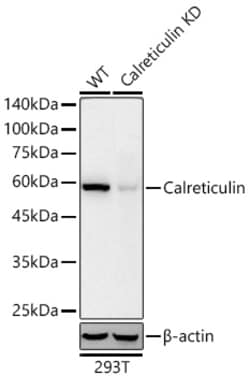 Invitrogen Calreticulin Recombinant Rabbit Monoclonal Antibody (7T5B2):Antibodies:Primary