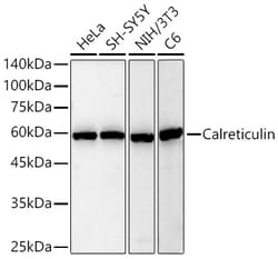 Invitrogen Calreticulin Recombinant Rabbit Monoclonal Antibody (7T5B2):Antibodies:Primary