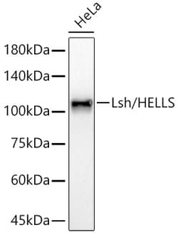 Invitrogen HELLS Recombinant Rabbit Monoclonal Antibody (4M7J3):Antibodies,