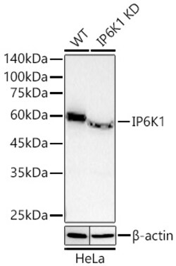 Invitrogen IP6K1 Recombinant Rabbit Monoclonal Antibody (3L6N2):Antibodies:Primary