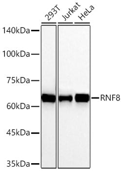 Invitrogen RNF8 Recombinant Rabbit Monoclonal Antibody (9V0X5) 20 &mu;L;