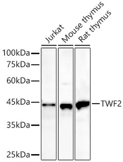 Invitrogen TWF2 Recombinant Rabbit Monoclonal Antibody (7K7A5):Antibodies:Primary
