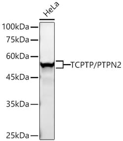Invitrogen PTPN2 Recombinant Rabbit Monoclonal Antibody (2J6D10) 20 &mu;L;