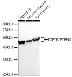 Invitrogen PTPN2 Recombinant Rabbit Monoclonal Antibody (2J6D10) 20 &mu;L;