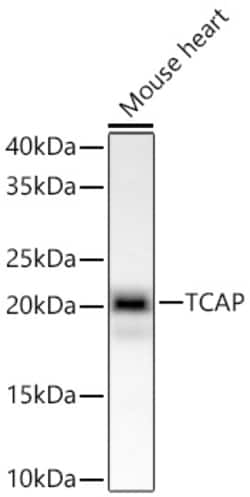 Invitrogen TCAP Recombinant Rabbit Monoclonal Antibody (7E2Z4):Antibodies:Primary