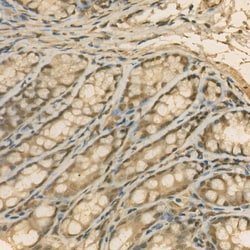 Invitrogen PSMC4 Recombinant Rabbit Monoclonal Antibody (5Z6T6):Antibodies:Primary