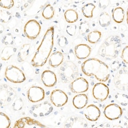 Invitrogen NGLY1 Recombinant Rabbit Monoclonal Antibody (9C10R7) 100 &mu;L;