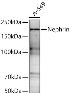 Invitrogen Nephrin Recombinant Rabbit Monoclonal Antibody (1S4U2):Antibodies:Primary
