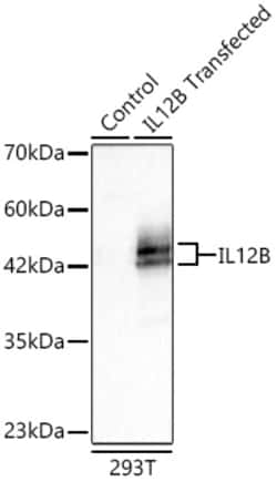 Invitrogen IL-12 p40 Recombinant Rabbit Monoclonal Antibody (4J2O7):Antibodies:Primary