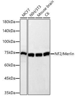 Invitrogen NF2 Recombinant Rabbit Monoclonal Antibody (4Q7P7):Antibodies:Primary