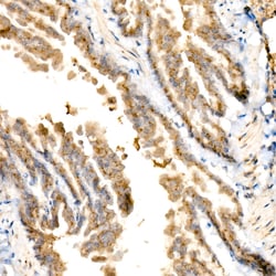 Invitrogen GOLGA4 Recombinant Rabbit Monoclonal Antibody (1I4T6) 100 &mu;L;