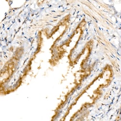 Invitrogen GOLGA4 Recombinant Rabbit Monoclonal Antibody (1I4T6) 100 &mu;L;