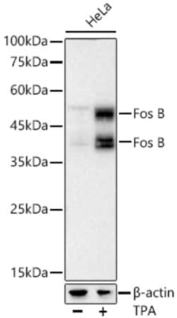Invitrogen FosB Recombinant Rabbit Monoclonal Antibody (6M9D5) 100 &mu;L;