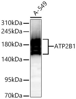 Invitrogen PMCA1 ATPase Recombinant Rabbit Monoclonal Antibody (1X7X6)