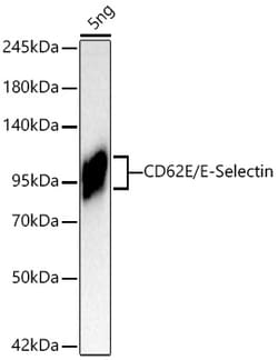 Invitrogen CD62E (E-Selectin) Recombinant Rabbit Monoclonal Antibody (9X1T0)
