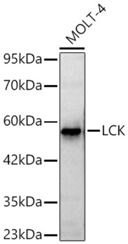 Invitrogen LCK Recombinant Rabbit Monoclonal Antibody (4C2L7):Antibodies:Primary