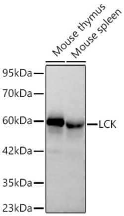 Invitrogen LCK Recombinant Rabbit Monoclonal Antibody (4C2L7):Antibodies:Primary