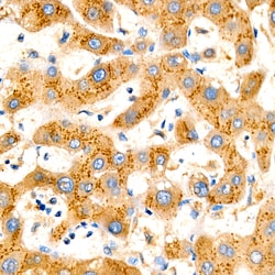 Invitrogen ASM Recombinant Rabbit Monoclonal Antibody (5T2N2):Antibodies:Primary