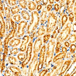 Invitrogen ASM Recombinant Rabbit Monoclonal Antibody (5T2N2) 100 &mu;L;