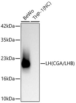 Invitrogen CGA Recombinant Rabbit Monoclonal Antibody (0I8N3):Antibodies:Primary