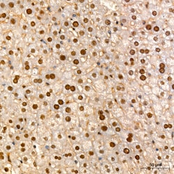 Invitrogen HNF6 Recombinant Rabbit Monoclonal Antibody (7L3O1):Antibodies:Primary