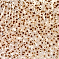Invitrogen HNF6 Recombinant Rabbit Monoclonal Antibody (7L3O1):Antibodies:Primary