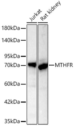 Invitrogen MTHFR Recombinant Rabbit Monoclonal Antibody (6Q5C1) 20 &mu;L;