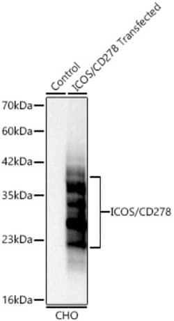 Invitrogen ICOS (CD278) Recombinant Rabbit Monoclonal Antibody (8P2G3)