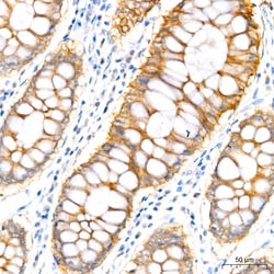 Invitrogen PER1 Recombinant Rabbit Monoclonal Antibody (2Y1M7) 20 &mu;L;