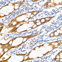 Invitrogen PER1 Recombinant Rabbit Monoclonal Antibody (2Y1M7) 20 &mu;L;