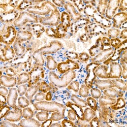 Invitrogen PER1 Recombinant Rabbit Monoclonal Antibody (2Y1M7) 20 &mu;L;