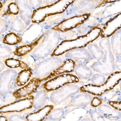 Invitrogen PER1 Recombinant Rabbit Monoclonal Antibody (2Y1M7) 20 &mu;L;