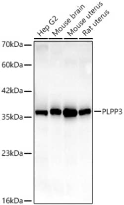 Invitrogen PPAP2B Recombinant Rabbit Monoclonal Antibody (6E10N3):Antibodies:Primary