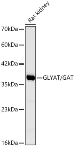 Invitrogen GLYAT Recombinant Rabbit Monoclonal Antibody (4F9J6) 100 &mu;L;