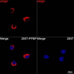 Invitrogen PPBP Recombinant Rabbit Monoclonal Antibody (8N6F1):Antibodies:Primary