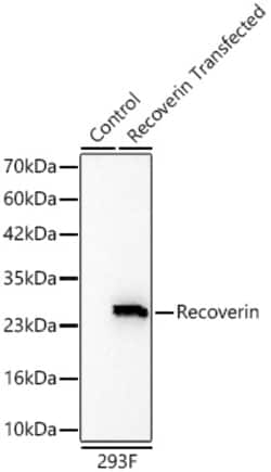 Invitrogen Recoverin Recombinant Rabbit Monoclonal Antibody (4G6B4):Antibodies:Primary