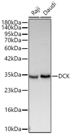 Invitrogen DCK Recombinant Rabbit Monoclonal Antibody (5S7P2) 20 &mu;L;