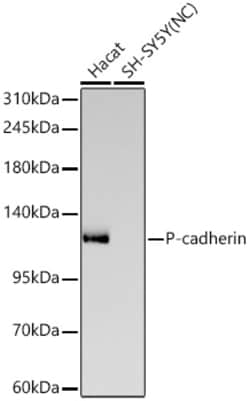 Invitrogen P-cadherin Recombinant Rabbit Monoclonal Antibody (8J5J8):Antibodies:Primary