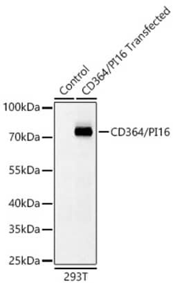Invitrogen PI16 Recombinant Rabbit Monoclonal Antibody (9Z5V7) 100 &mu;L;