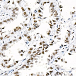 Invitrogen DNA-PK Recombinant Rabbit Monoclonal Antibody (4H6W7) 20 &mu;L;