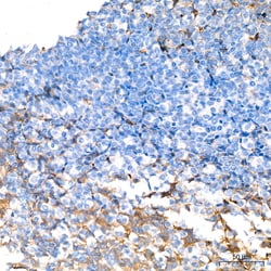 Invitrogen™ Follicle Stimulating Hormone Recombinant Rabbit Monoclonal Antibody (6R1V3)