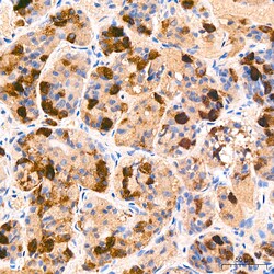 Invitrogen Follicle Stimulating Hormone Recombinant Rabbit Monoclonal Antibody