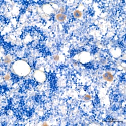 Invitrogen TGF beta-1 Recombinant Rabbit Monoclonal Antibody (9G3E3) 20