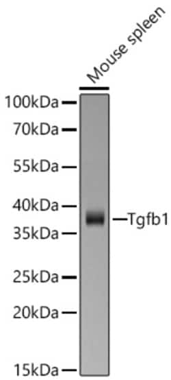 Invitrogen TGF beta-1 Recombinant Rabbit Monoclonal Antibody (9G3E3) 20