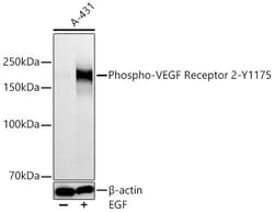 Invitrogen Phospho-VEGF Receptor 2 (Tyr1175) Recombinant Rabbit Monoclonal
